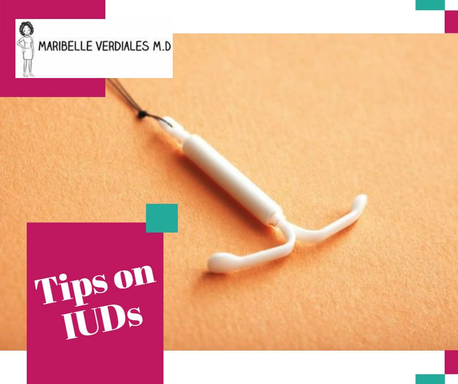 Tips on IUDs
